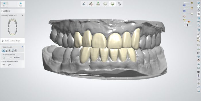 Diagnostic wax mock fig patient op pre smile communication photograph