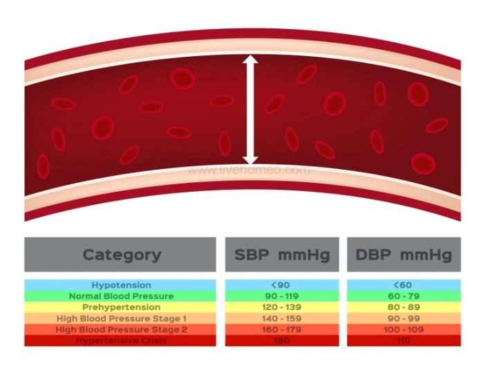 What does hypertension influence weegy